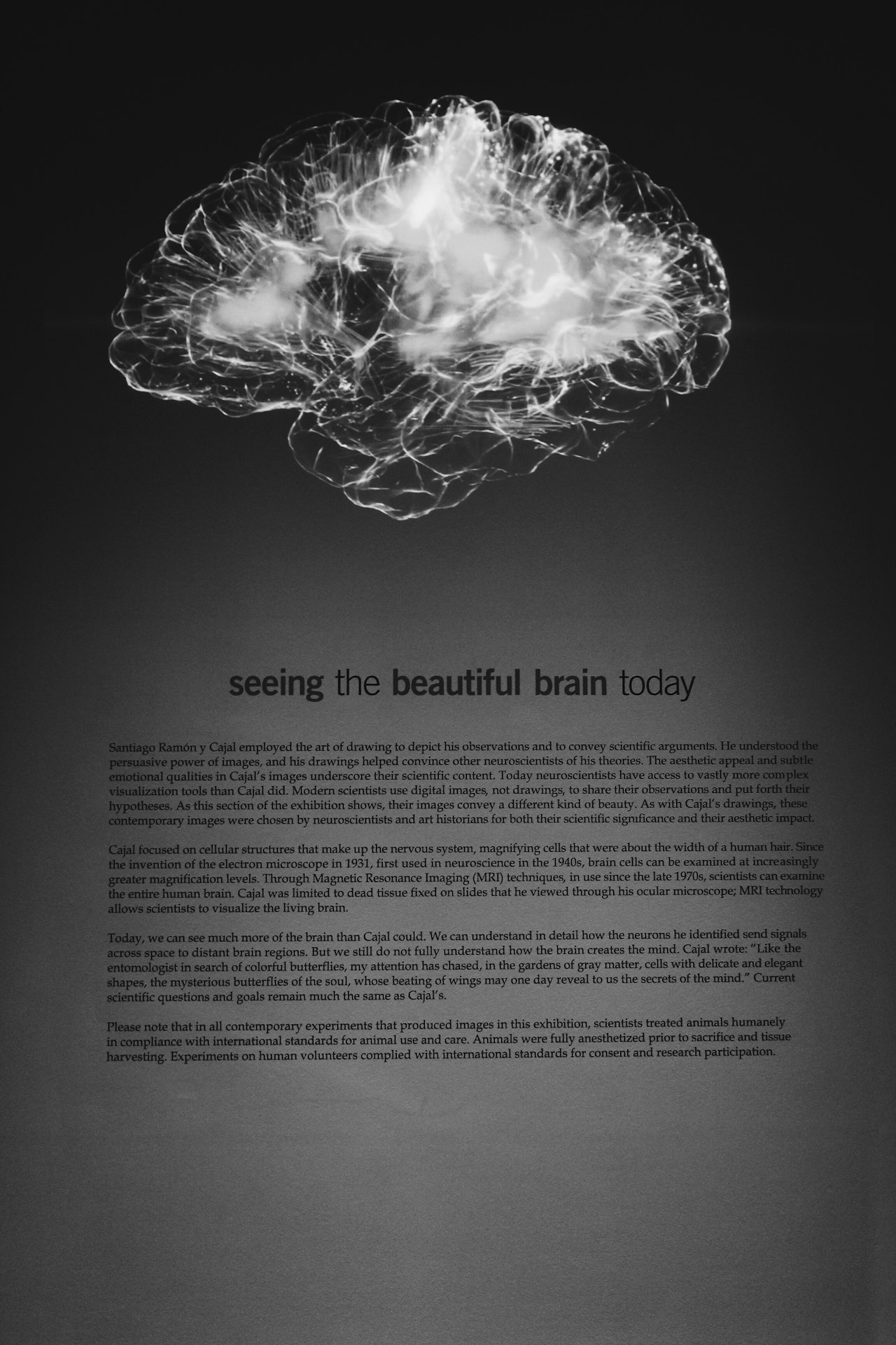 Une toile de nœuds connectés — un écho visuel des motifs d'impulsions que l'implant enregistre puis rejoue. Crédit : Alina Grubnyak, Unsplash (licence Unsplash)