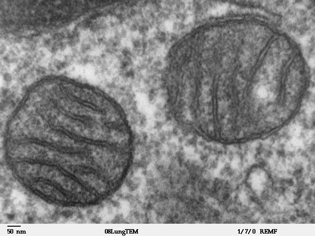 Des mitochondries (les corps ovales sombres) à l'intérieur d'une cellule de tissu pulmonaire de mammifère, vues au microscope électronique à transmission — Crédit : Louisa Howard, Dartmouth (domaine public)